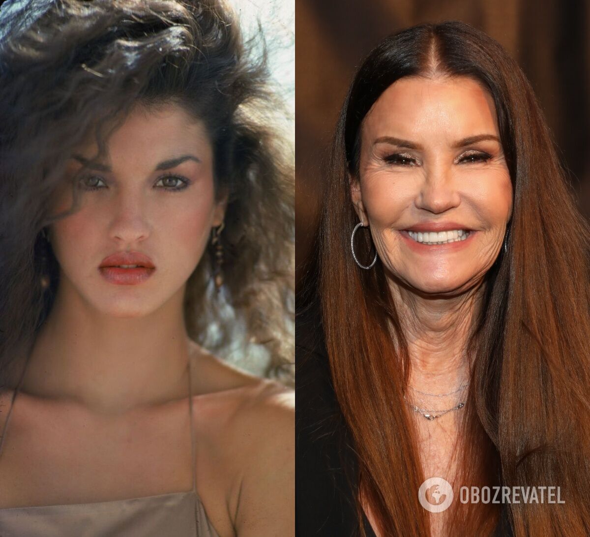 Clearly too much: 5 stars who disfigured themselves with plastic surgery