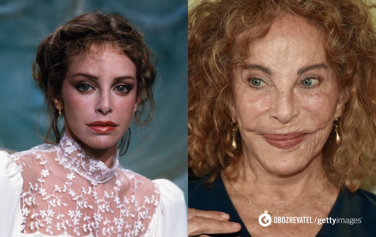 Clearly too much: 5 stars who disfigured themselves with plastic surgery