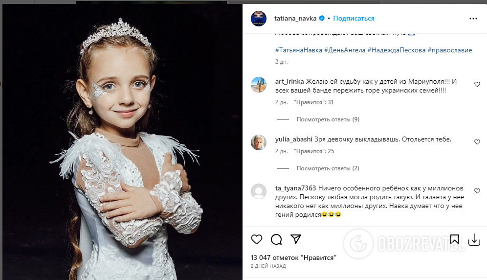 ''Braces are for slaves'': Navka's Instagram post infuriated Russians