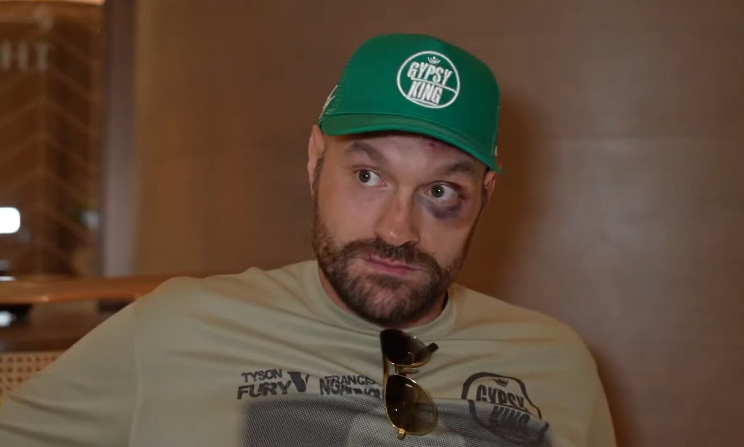 For Usyk's information: 7 times Tyson Fury was knocked down. Video