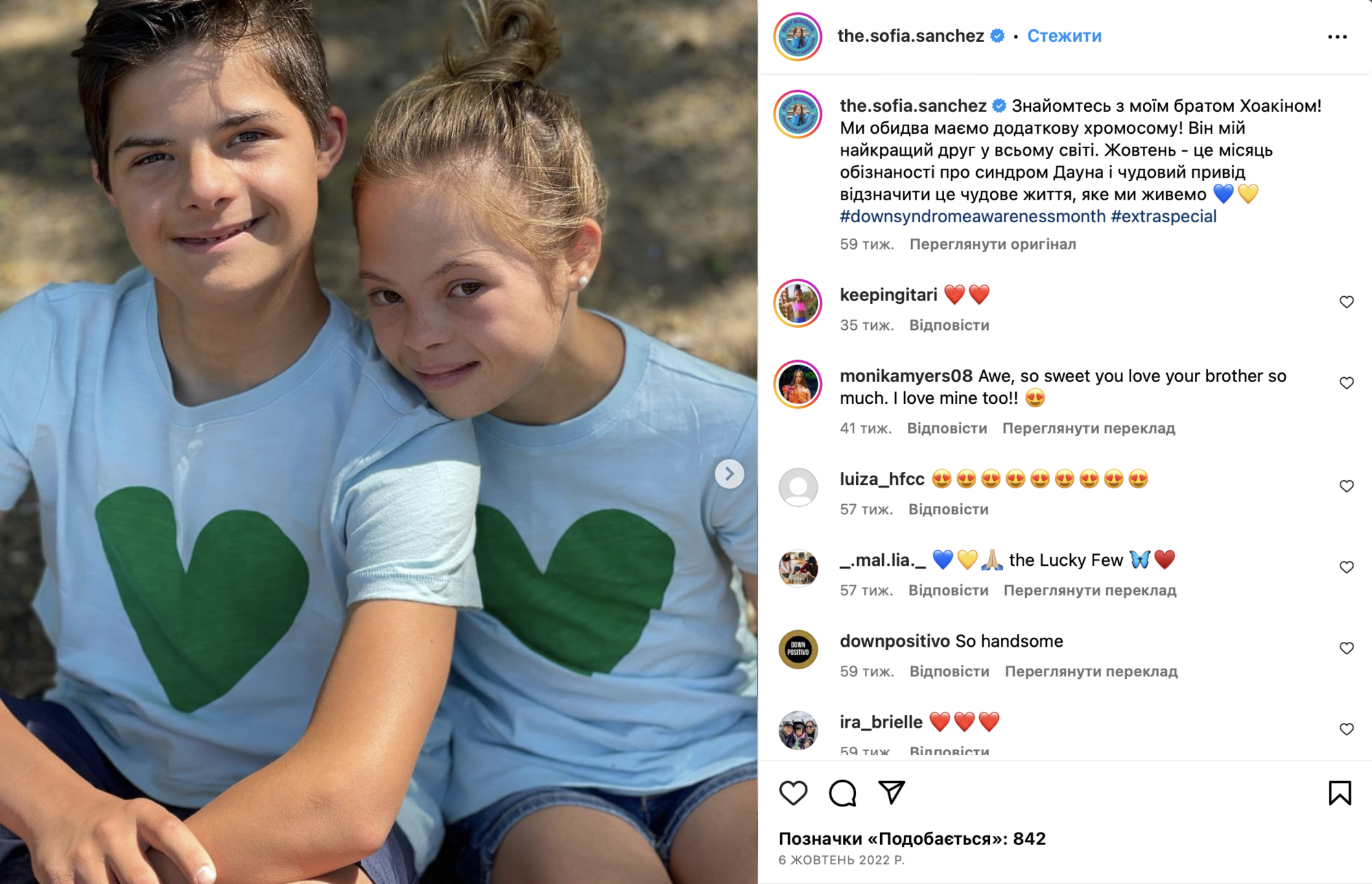 Młoda gwiazda Igrzysk śmierci i Barbie z zespołem Downa okazała się Ukrainką: co o niej wiadomo i jak wspiera swój ojczysty kraj