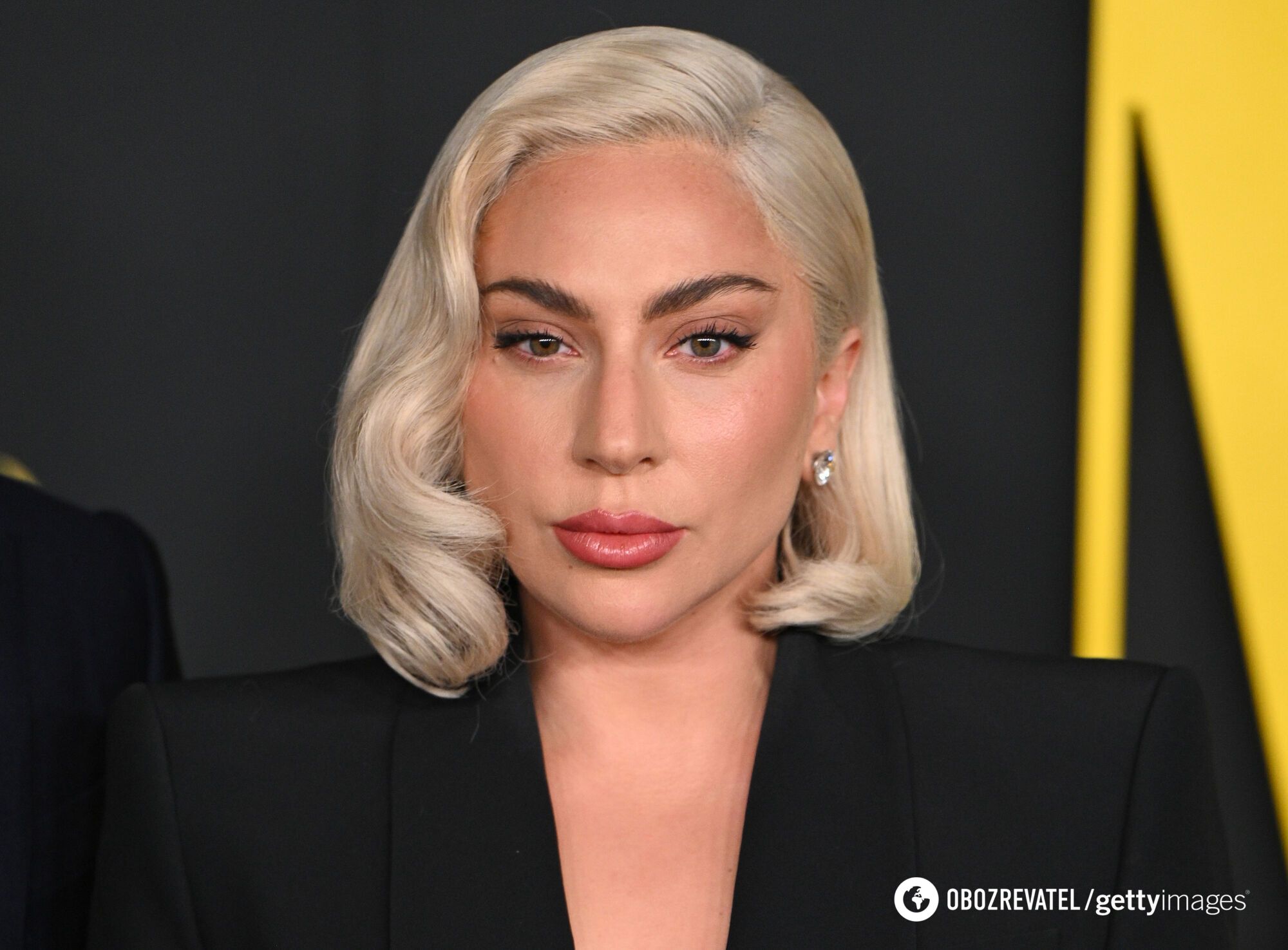 37-letnia Lady Gaga rozczarowała fanów botoksem i wypełniaczami na twarzy. Zdjęcia przed i po