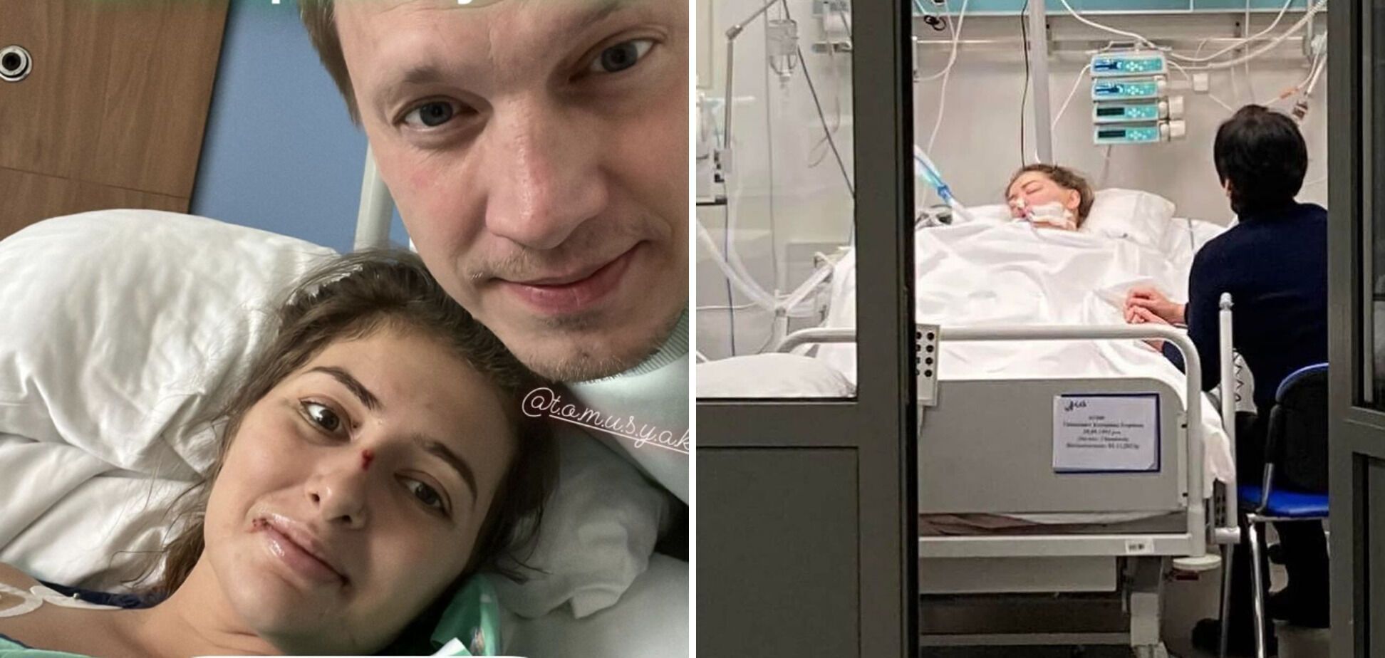 The miracle has happened: seriously ill Kateryna Tyshkevych is already smiling and kissing her husband