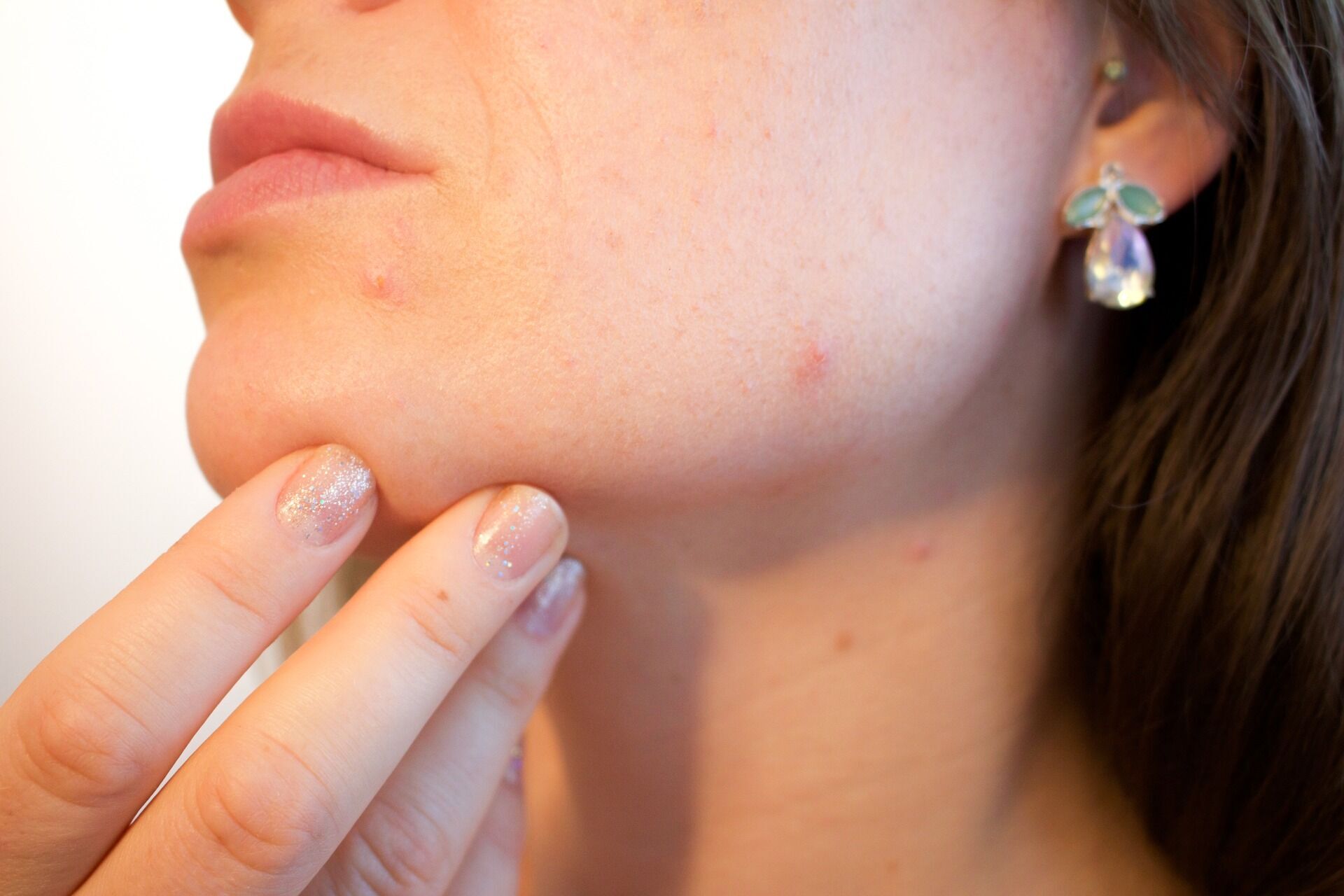 An abundance of cosmetics can lead to inflammation