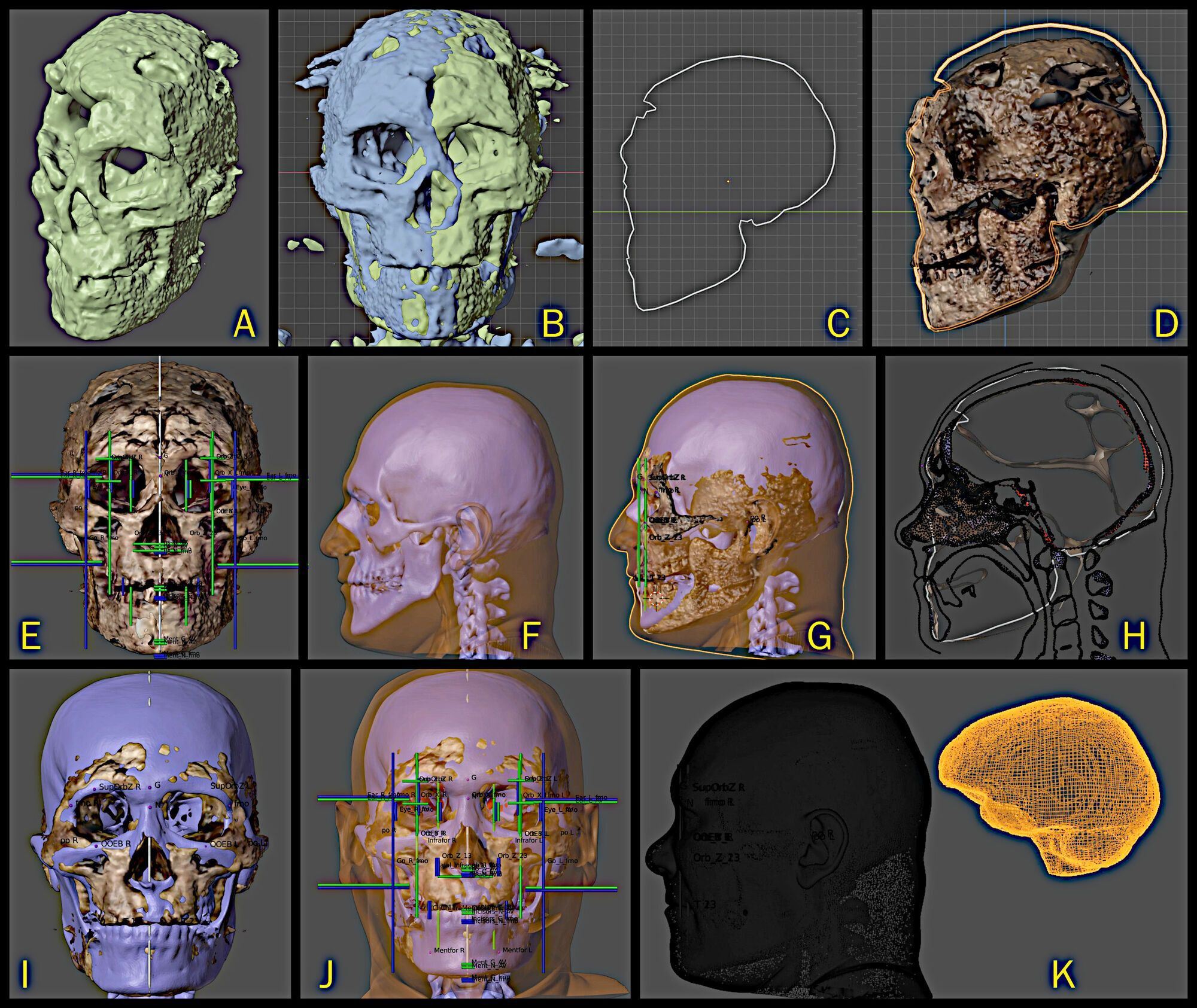 The process of digital reconstruction of the Homo sapiens skull.