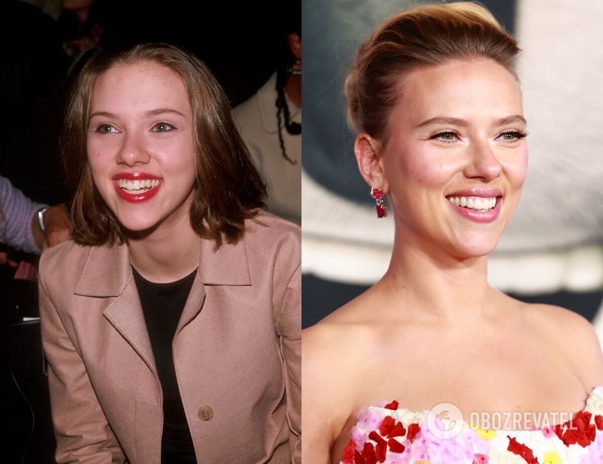 Hiding smile imperfections: 5 star beauties who have artificial teeth. Before and after photos