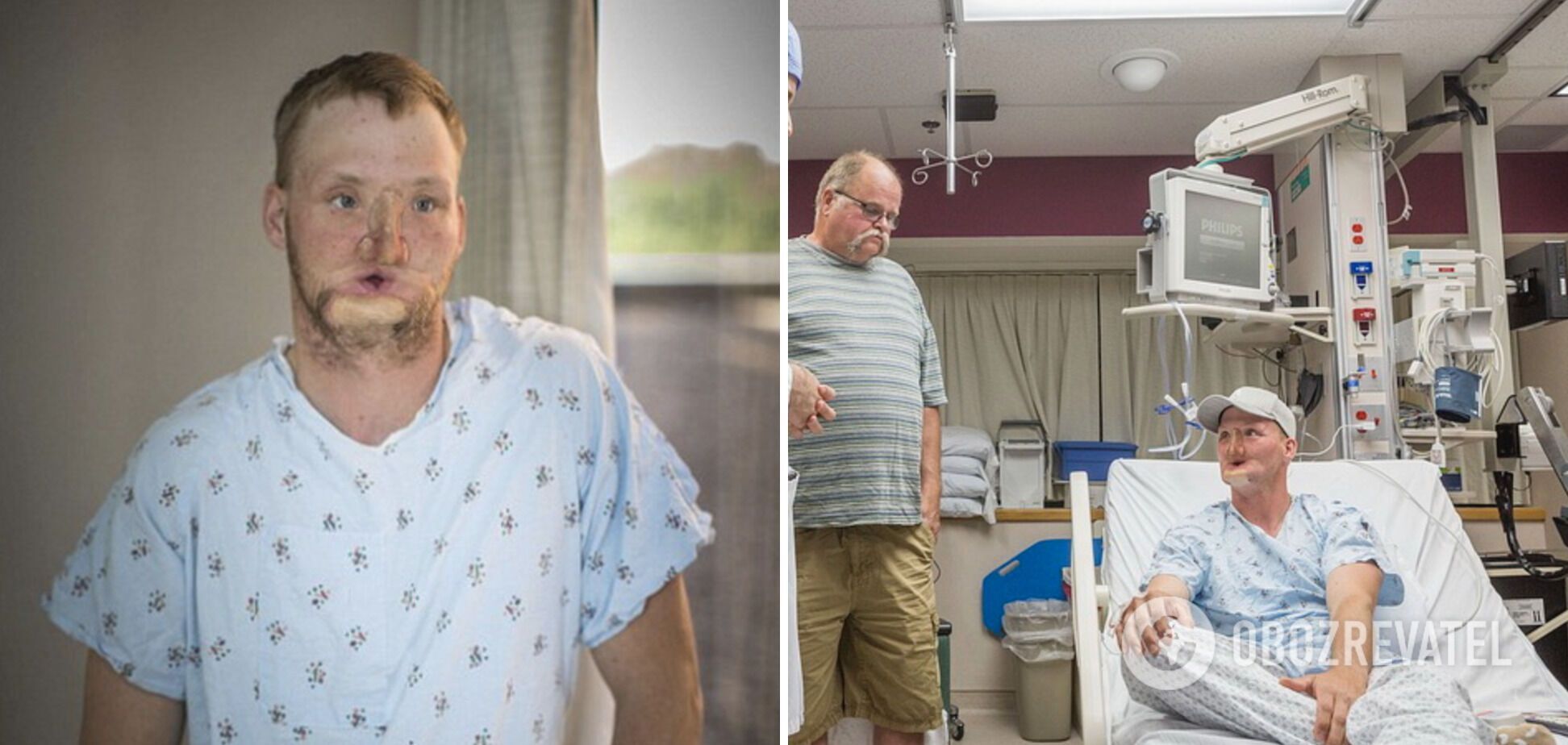 Andy was treated for a long time before his transplant