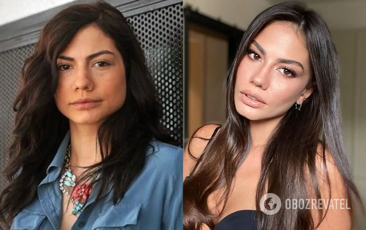 5 beautiful actresses from Turkish TV series who had plastic surgery. Photos before and after
