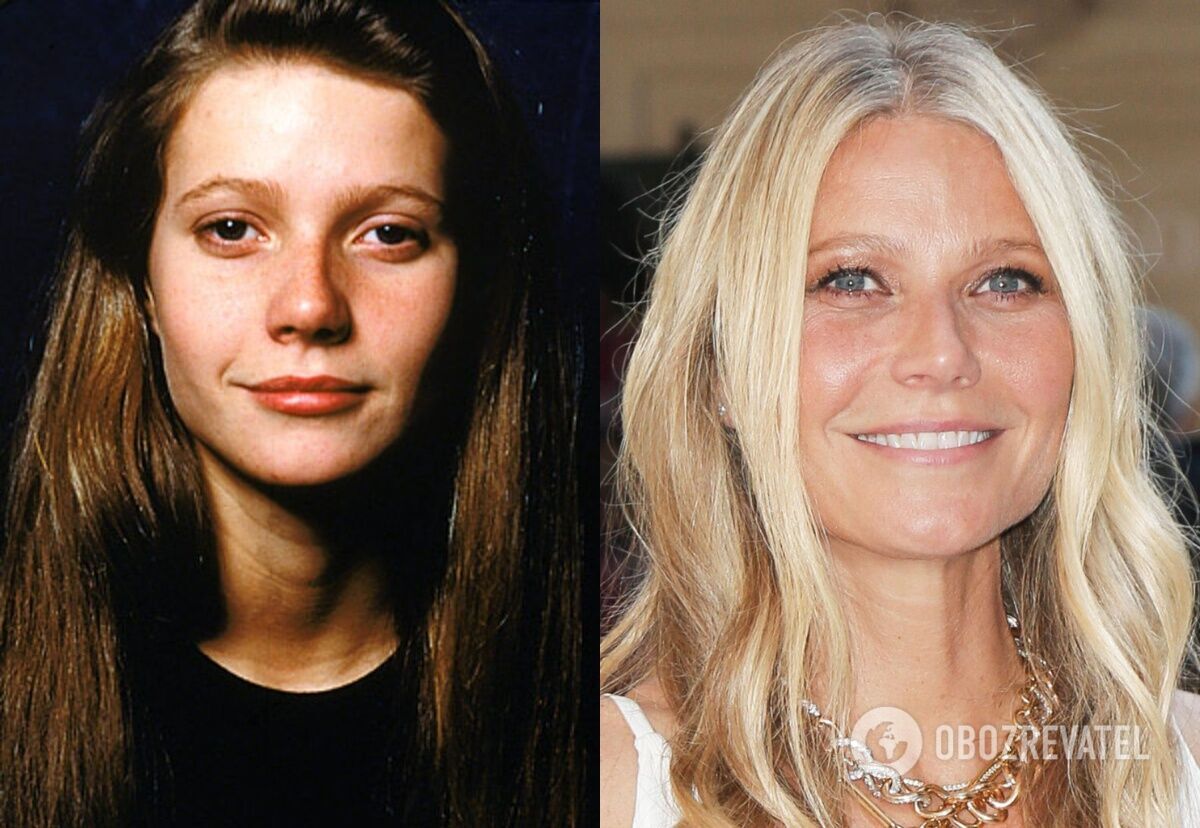 Keira Knightley, Gwyneth Paltrow and other stars who have had plastic surgery but won't admit it. Photo