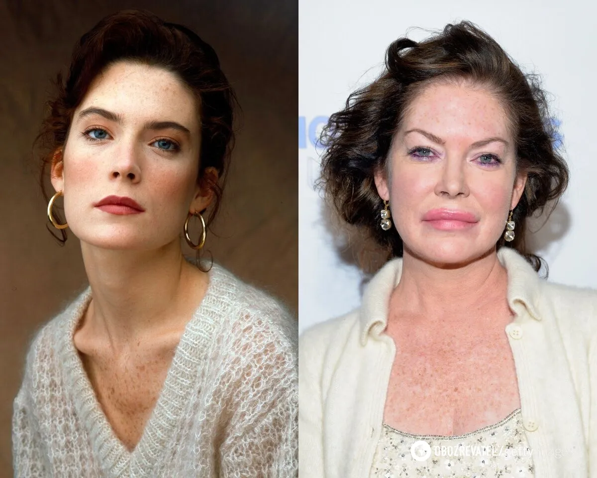 Overdoing it with Botox: Melanie Griffith, Courtney Cox and other celebrities who became victims of beauty. Photo