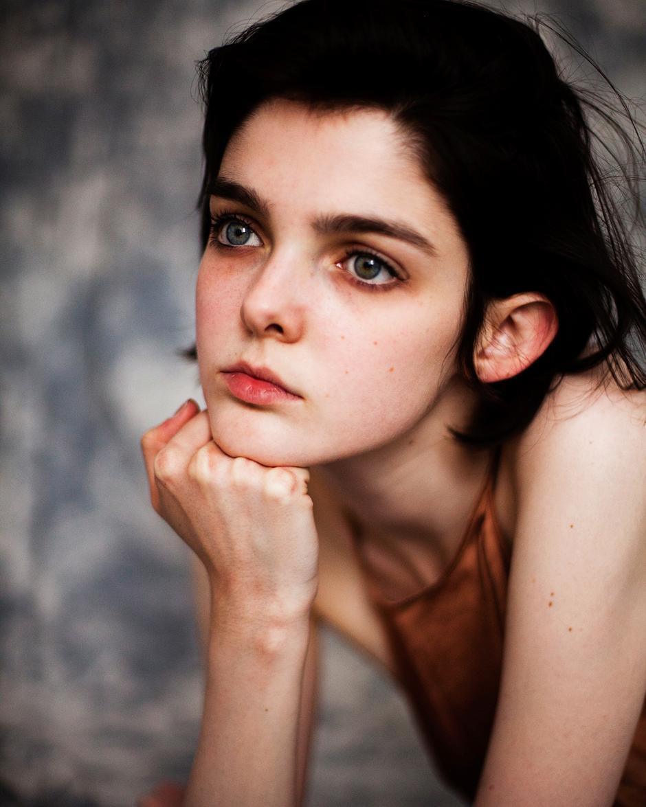''Scared elf'' and ''angel with sad eyes'': 5 models with unusual physical characteristics. Photo