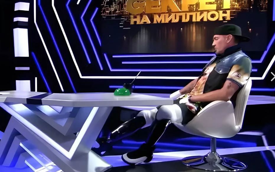 Russian Olympic champion who supported the war has his arms and legs amputated after going to the bathhouse