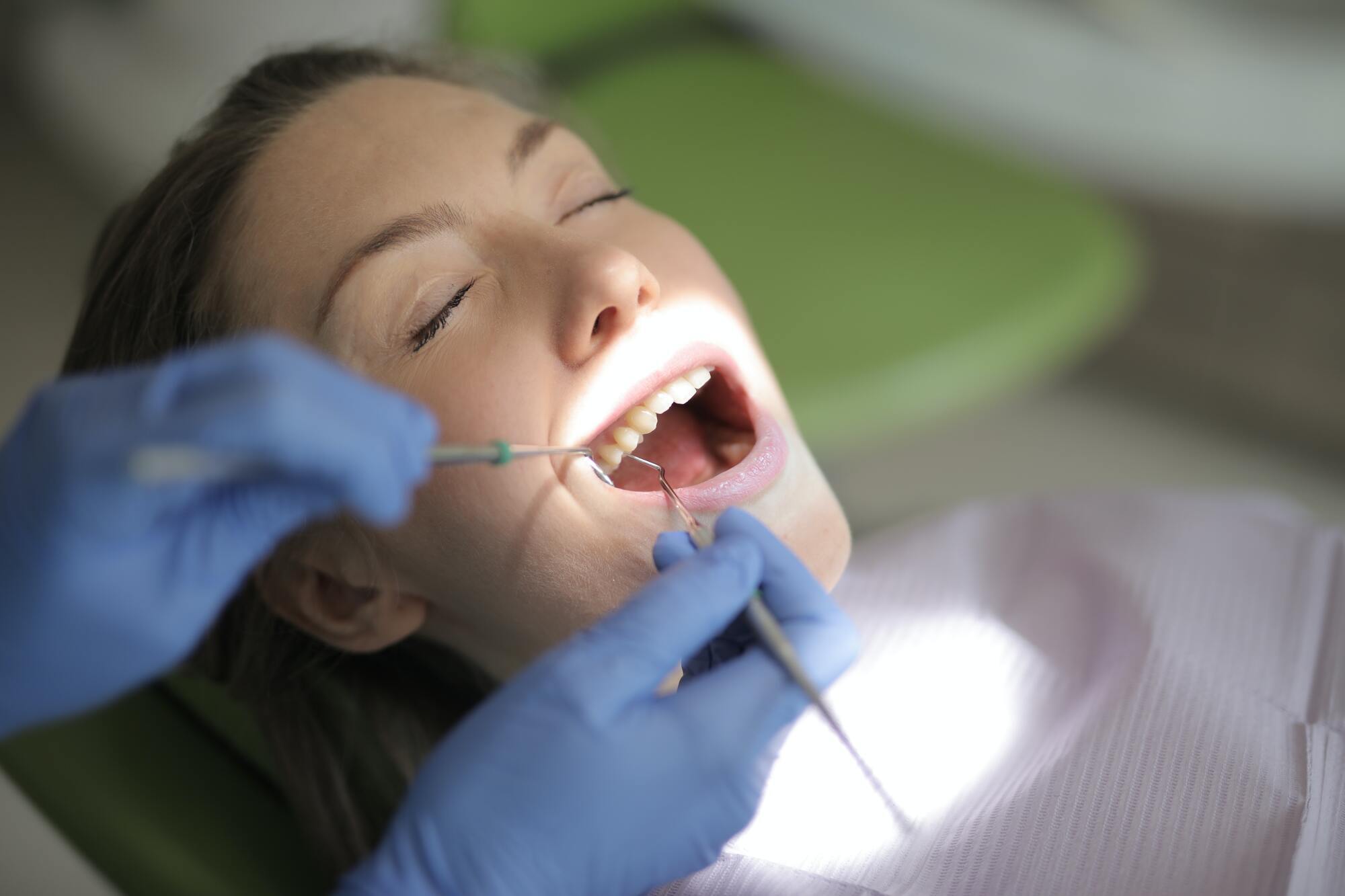 Before placing veneers, the enamel layer is polished