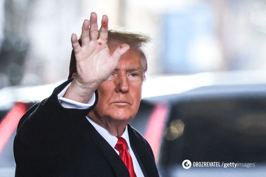 Mysterious red spots spotted on Trump's hand: photo confused the network
