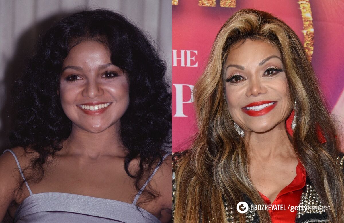 They didn't stop in time: 5 stars who have changed themselves beyond recognition with plastic surgery