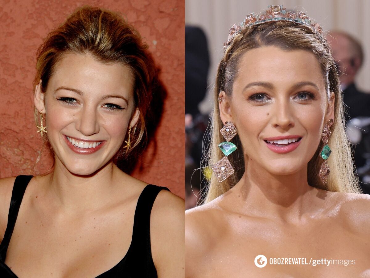 Surgeons did a great job: 5 stars who had plastic surgery and you didn't even notice