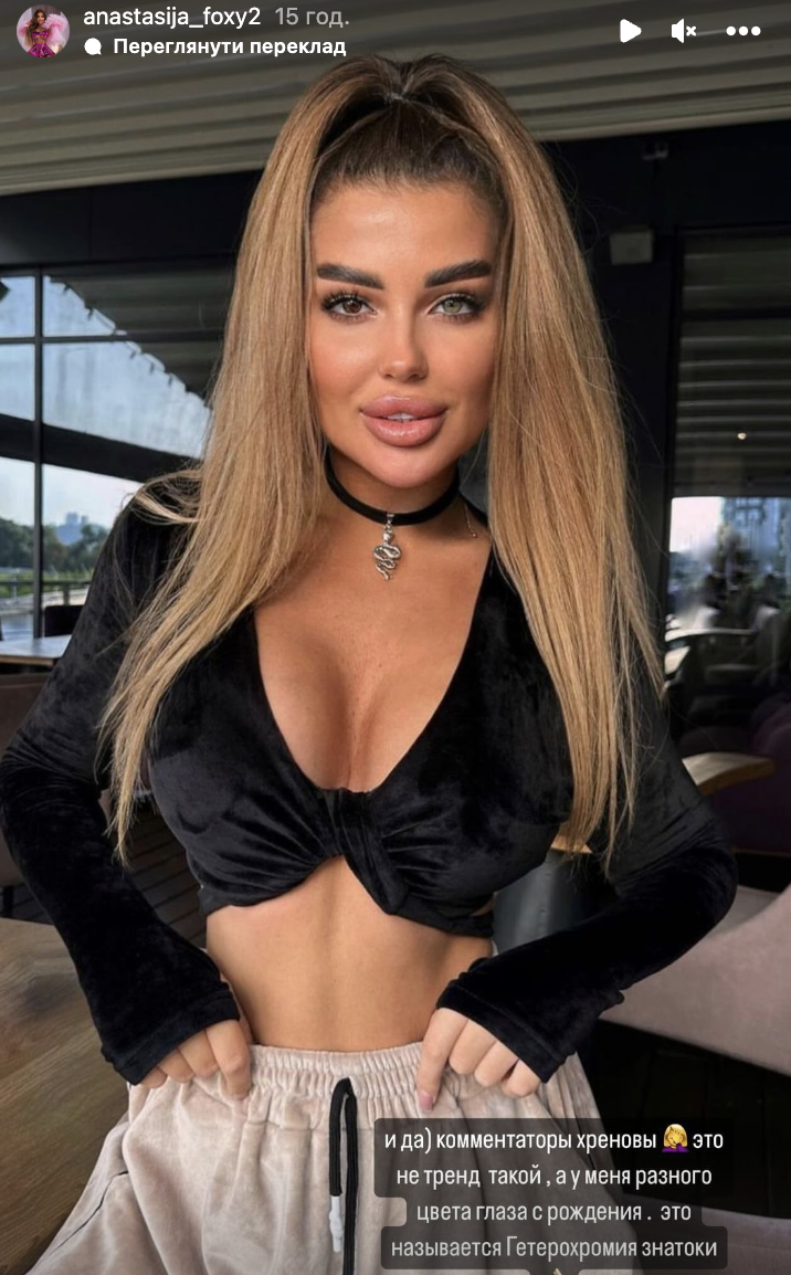 She has a son, heterochromia and was abused: what we know about Murat Nalçacıoğlu's new girlfriend who promotes Russian culture
