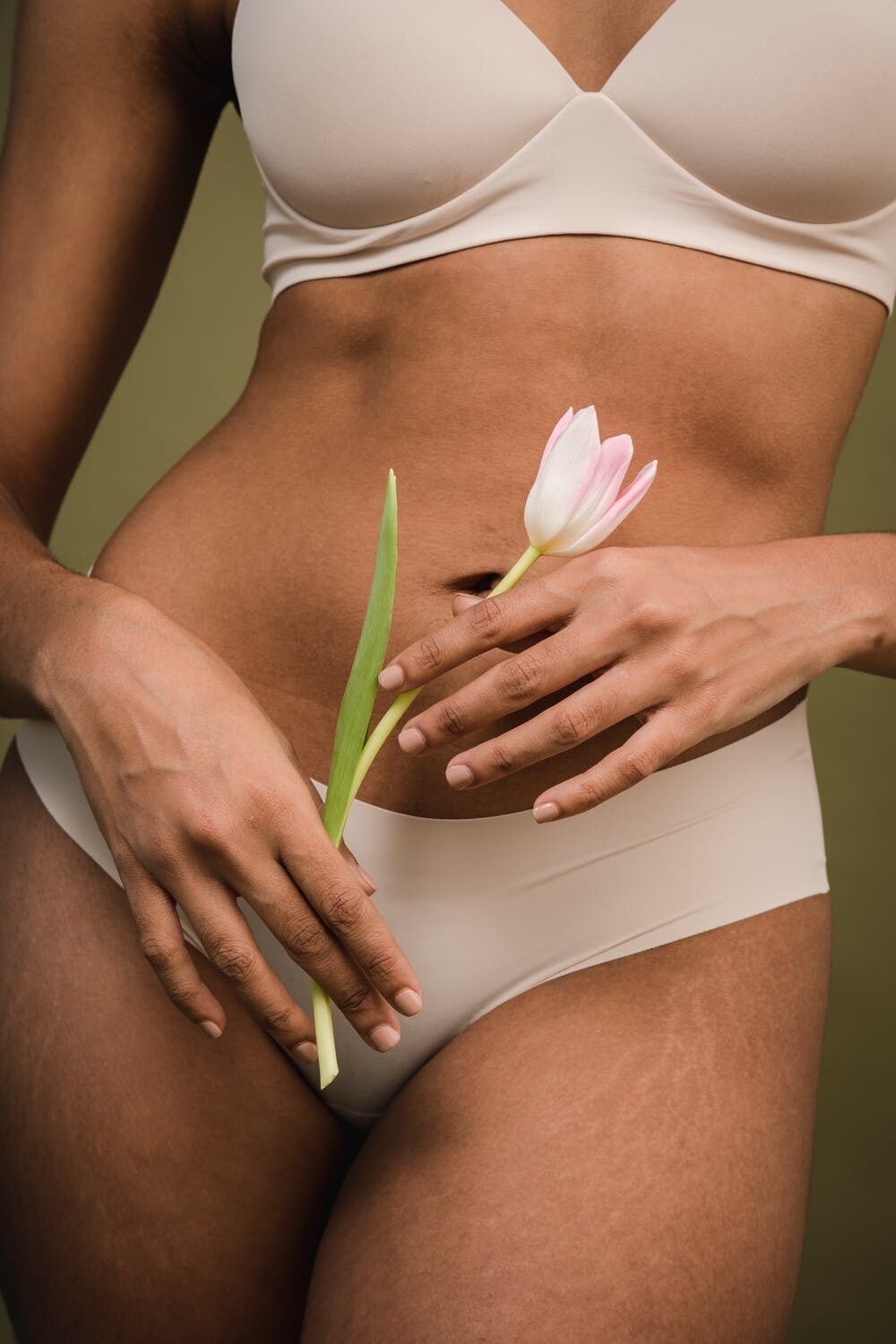 Most girls consider stretch marks to be a flaw