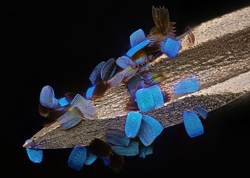 Beetle eyes, pregnant fleas and mouse brain tumors: 10 impressive photos of the microscopic world