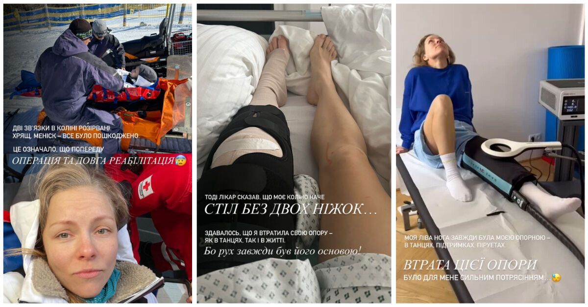 For the first time, Olena Shoptenko spoke about the accident that forced her to use crutches: I couldn't foresee it