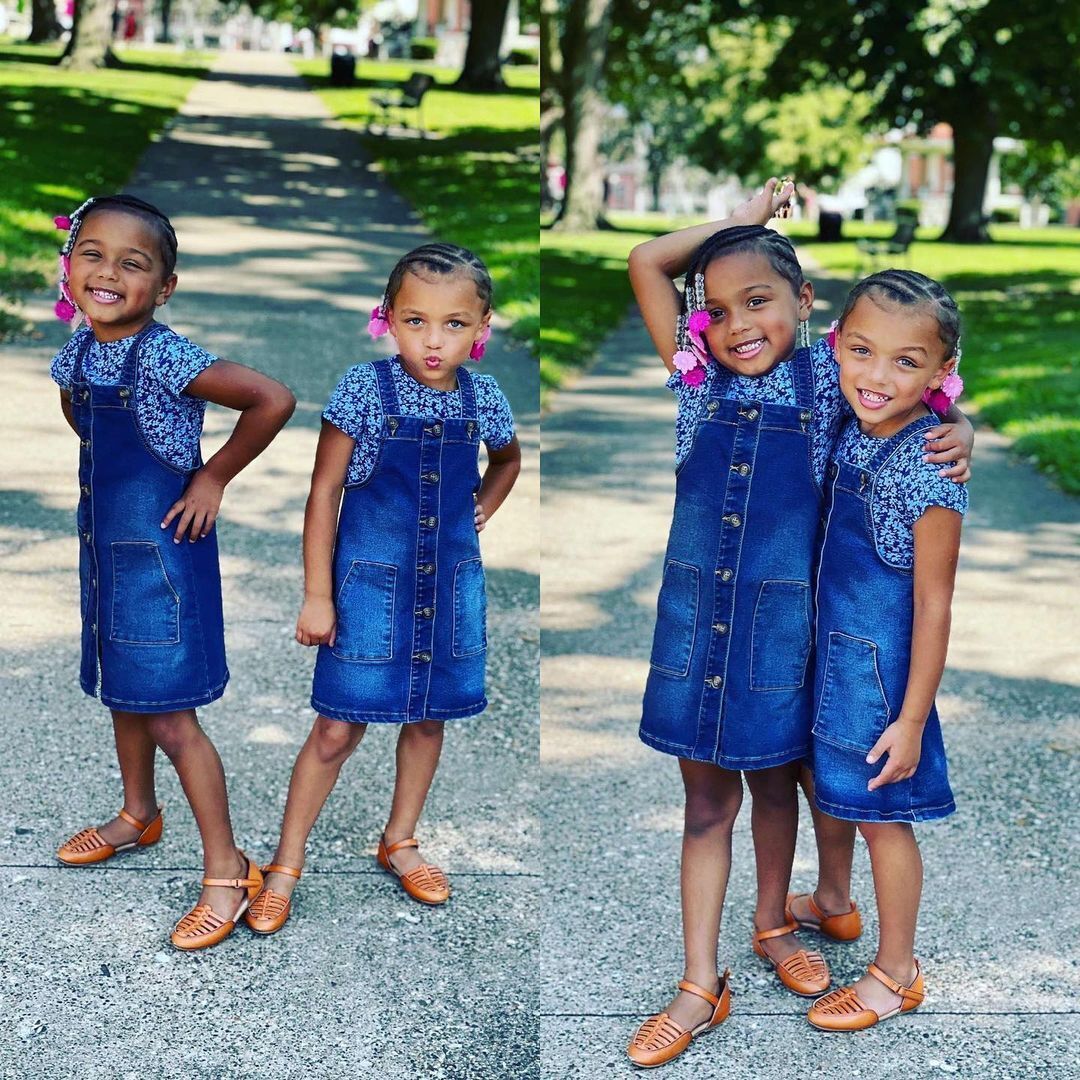 What the twins from the United States, who were born with different skin colors, look like today. Photo of 7-year-old Kalani and Jarani