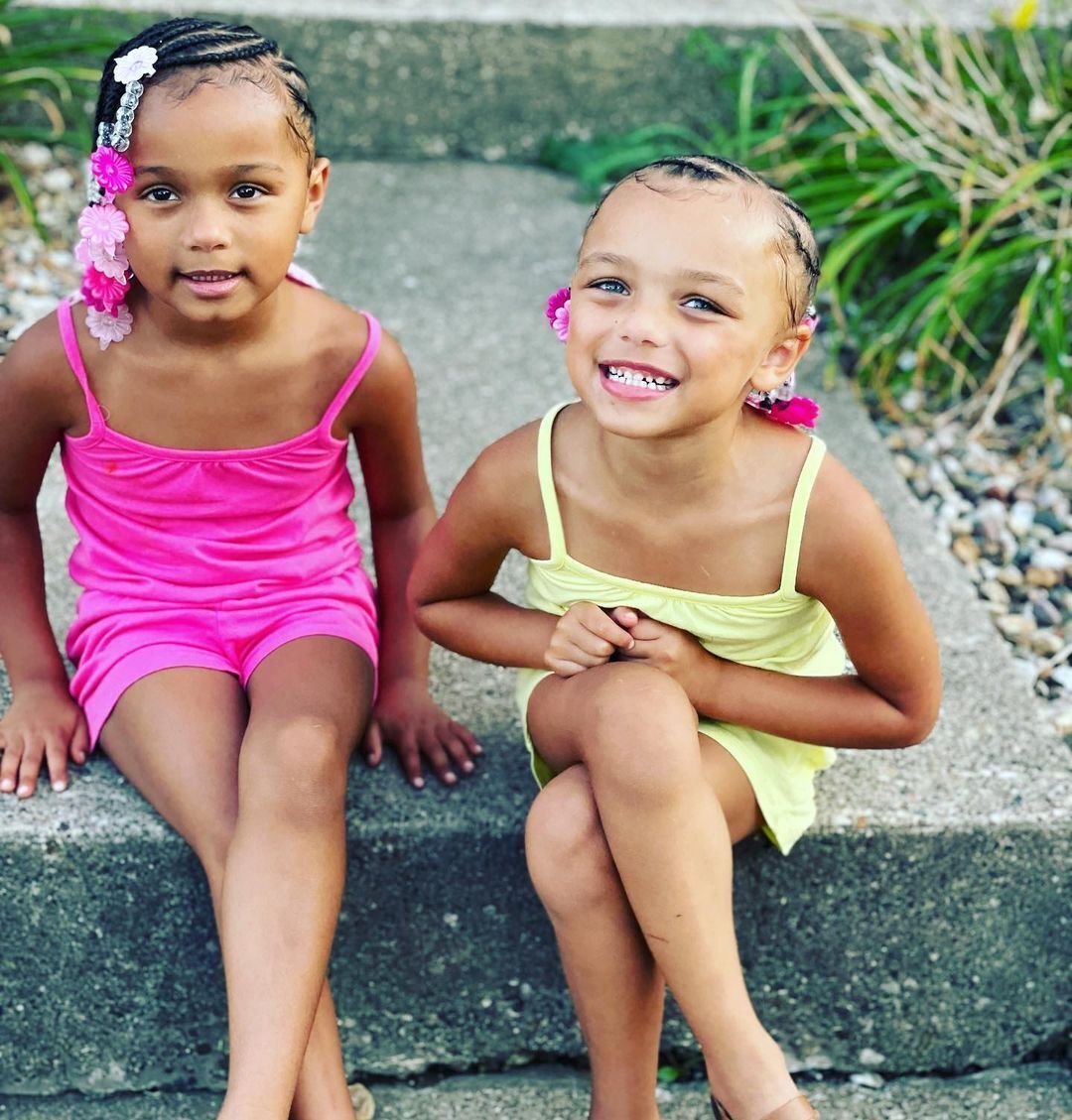 What the twins from the United States, who were born with different skin colors, look like today. Photo of 7-year-old Kalani and Jarani