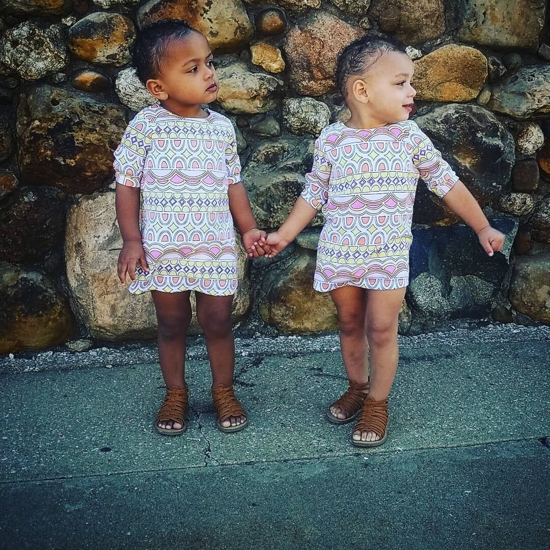 What the twins from the United States, who were born with different skin colors, look like today. Photo of 7-year-old Kalani and Jarani