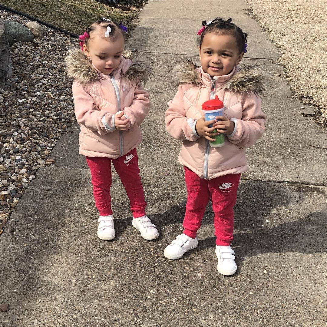 What the twins from the United States, who were born with different skin colors, look like today. Photo of 7-year-old Kalani and Jarani