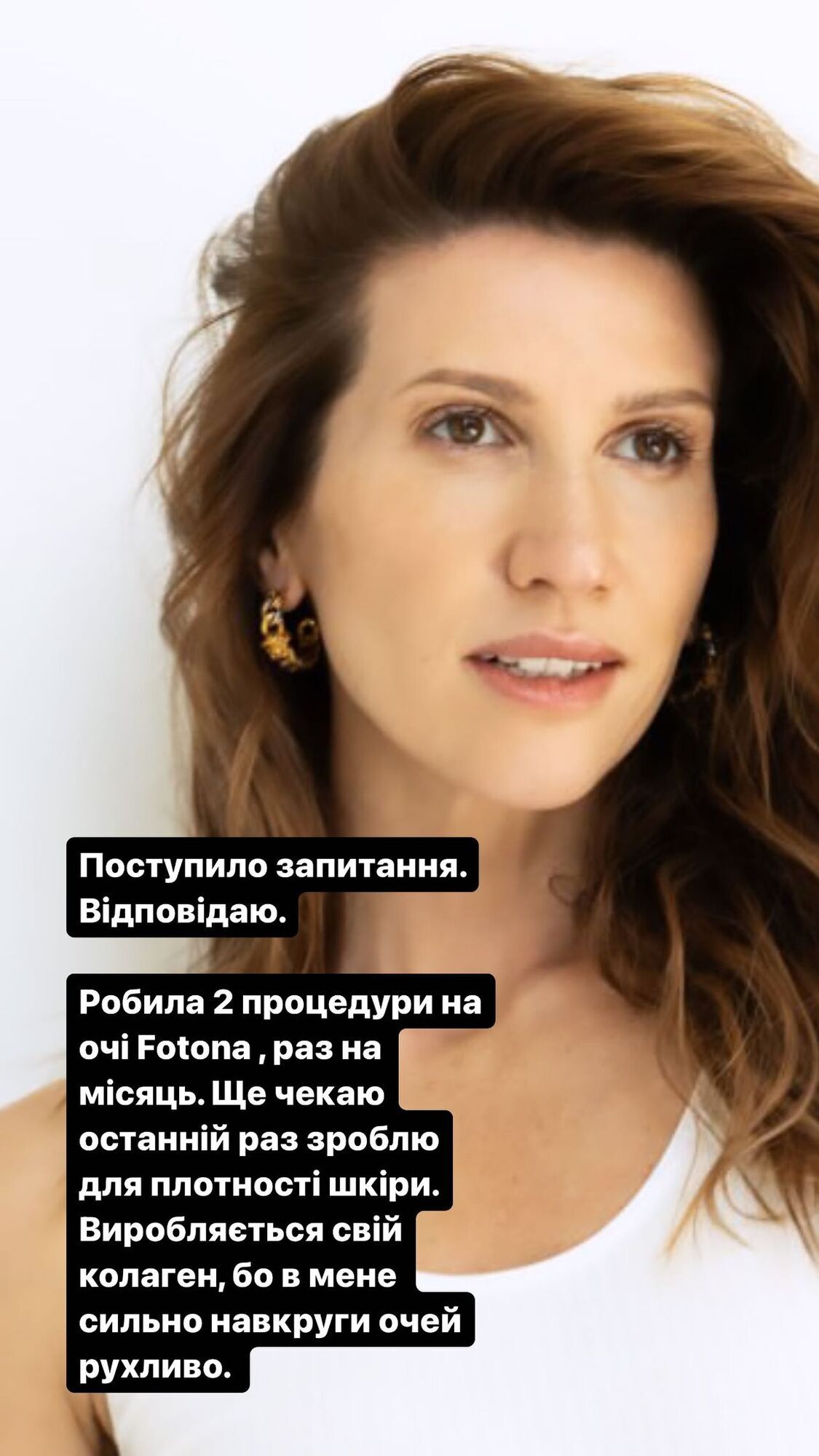 Anita Lutsenko spoke frankly about beauty injections and called her ''small breasts'' perfect