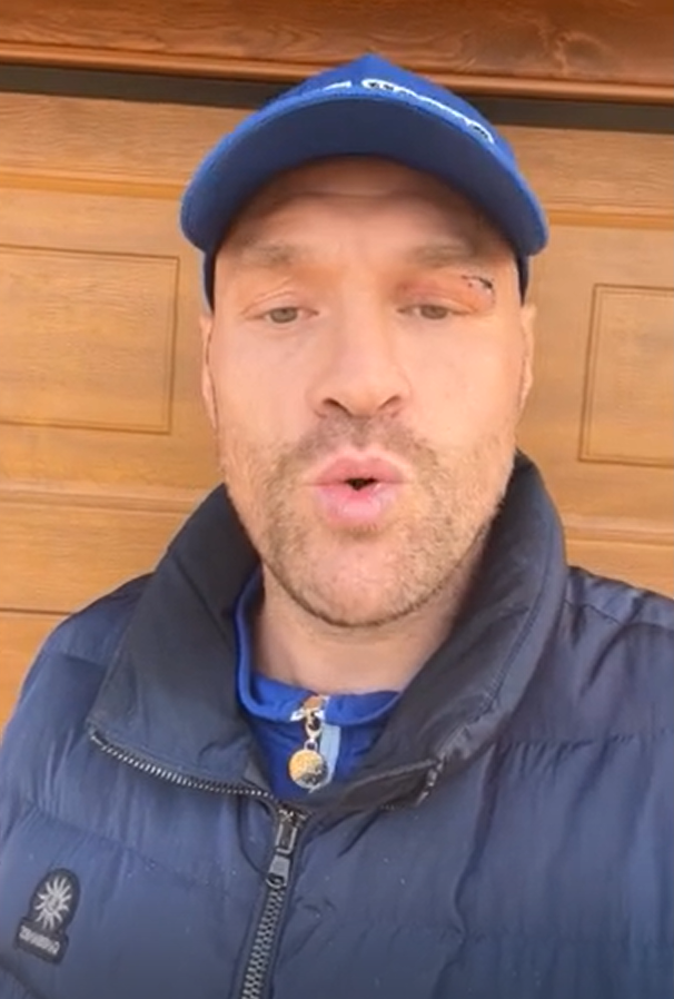 Tyson Fury made a statement about his career ending, announcing five fights at once. Video.