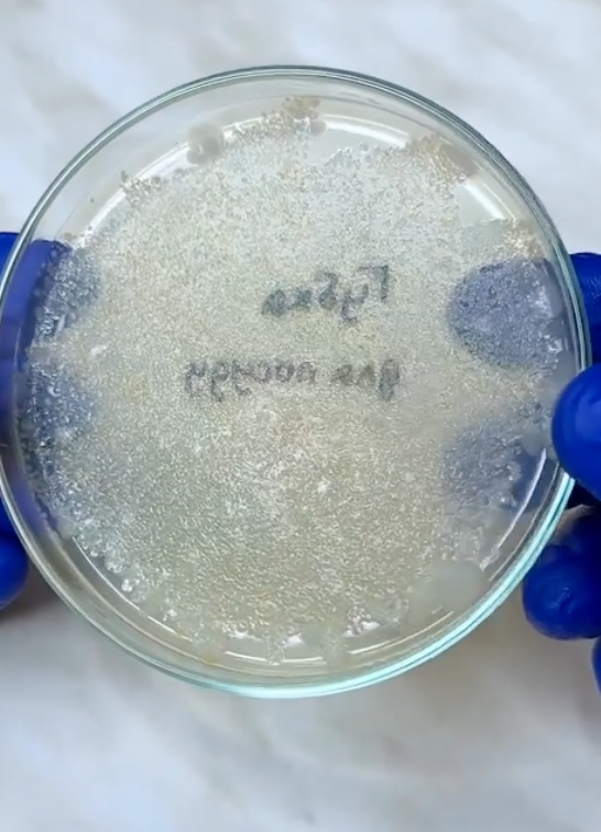 Microbes on the surface of a sponge