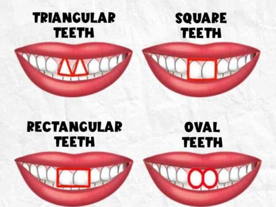 The shape of your teeth can reveal your character traits: a personality test