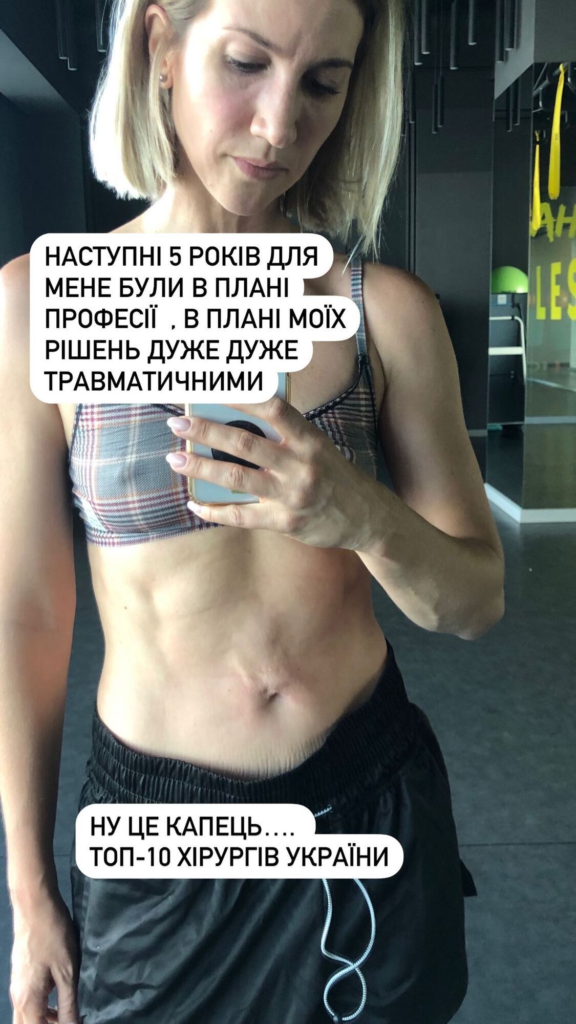 For the first time, Anita Lutsenko showed a photo of how she was disfigured by a surgeon from the top 10 best in Ukraine and explained why she has been hiding her stomach lately
