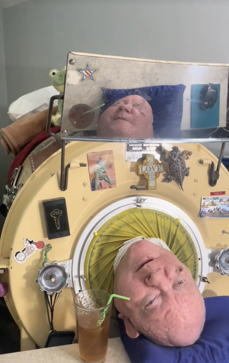 A man who lived in an ''iron lung'' for more than 70 years has died: who is Paul Alexander and why the American lawyer was known all over the world. Photo.