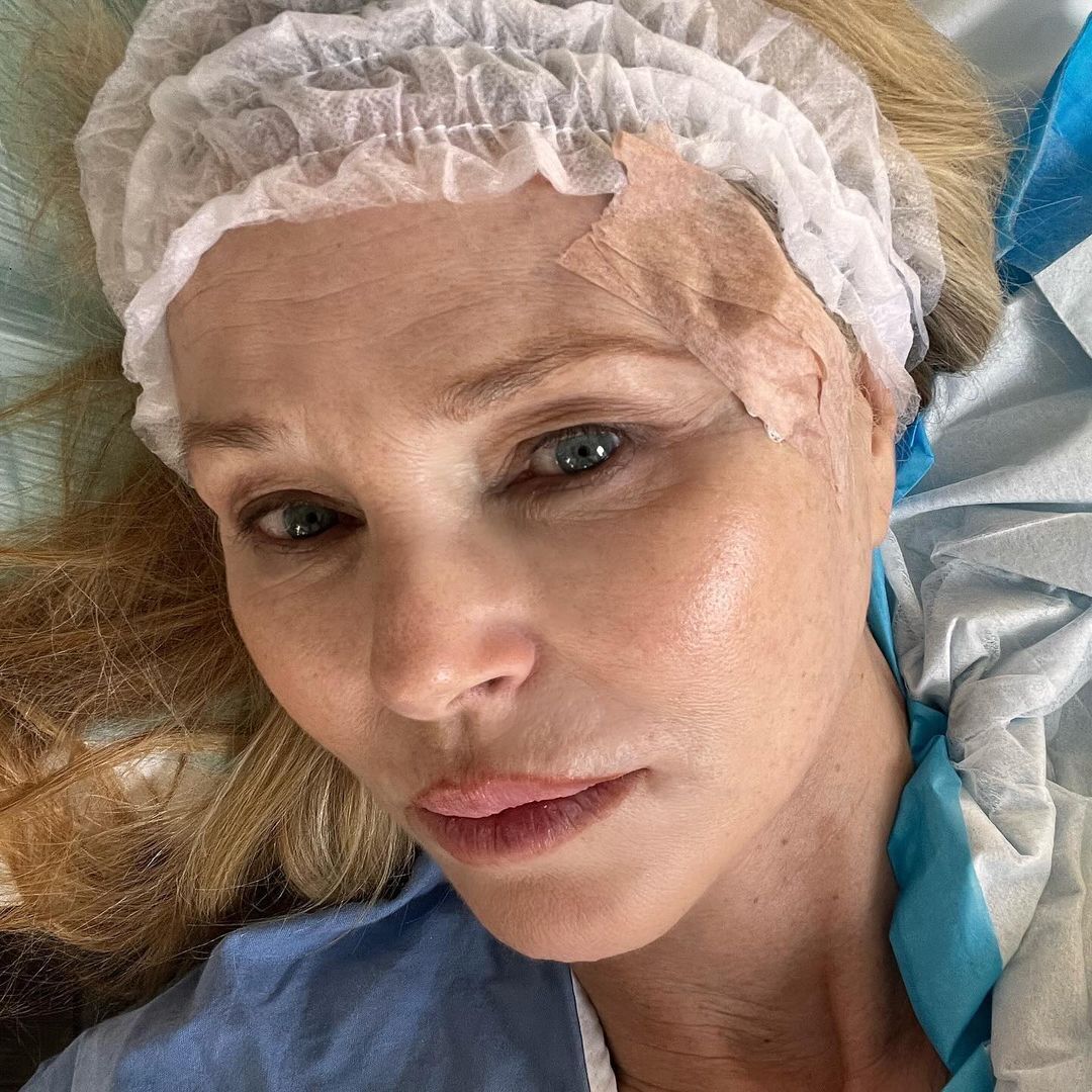 Christie Brinkley has been diagnosed with skin cancer: 70-year-old supermodel shows first photos after surgery