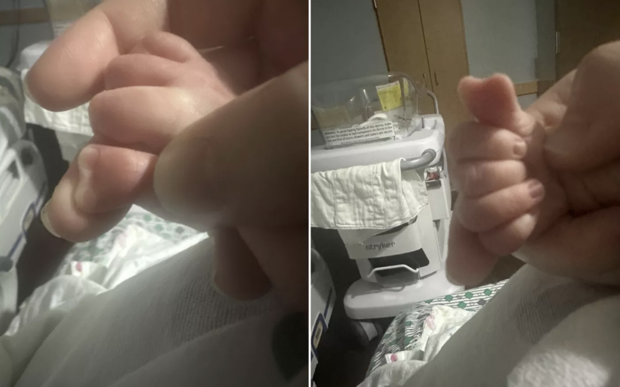 Doctors have never seen anything like it: a boy with a heart-shaped thumb was born in the United States. Photo