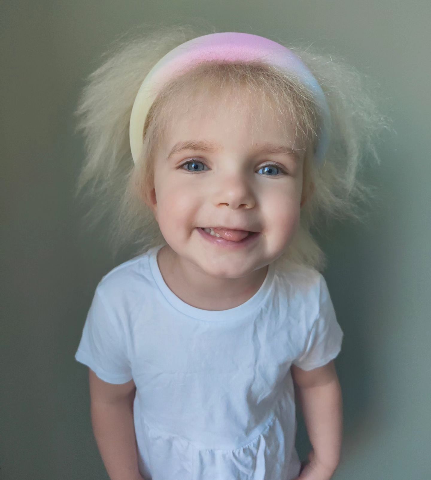 A three-year-old girl from Great Britain was diagnosed with uncombed hair syndrome: there are only 100 such people in the world. Photo.
