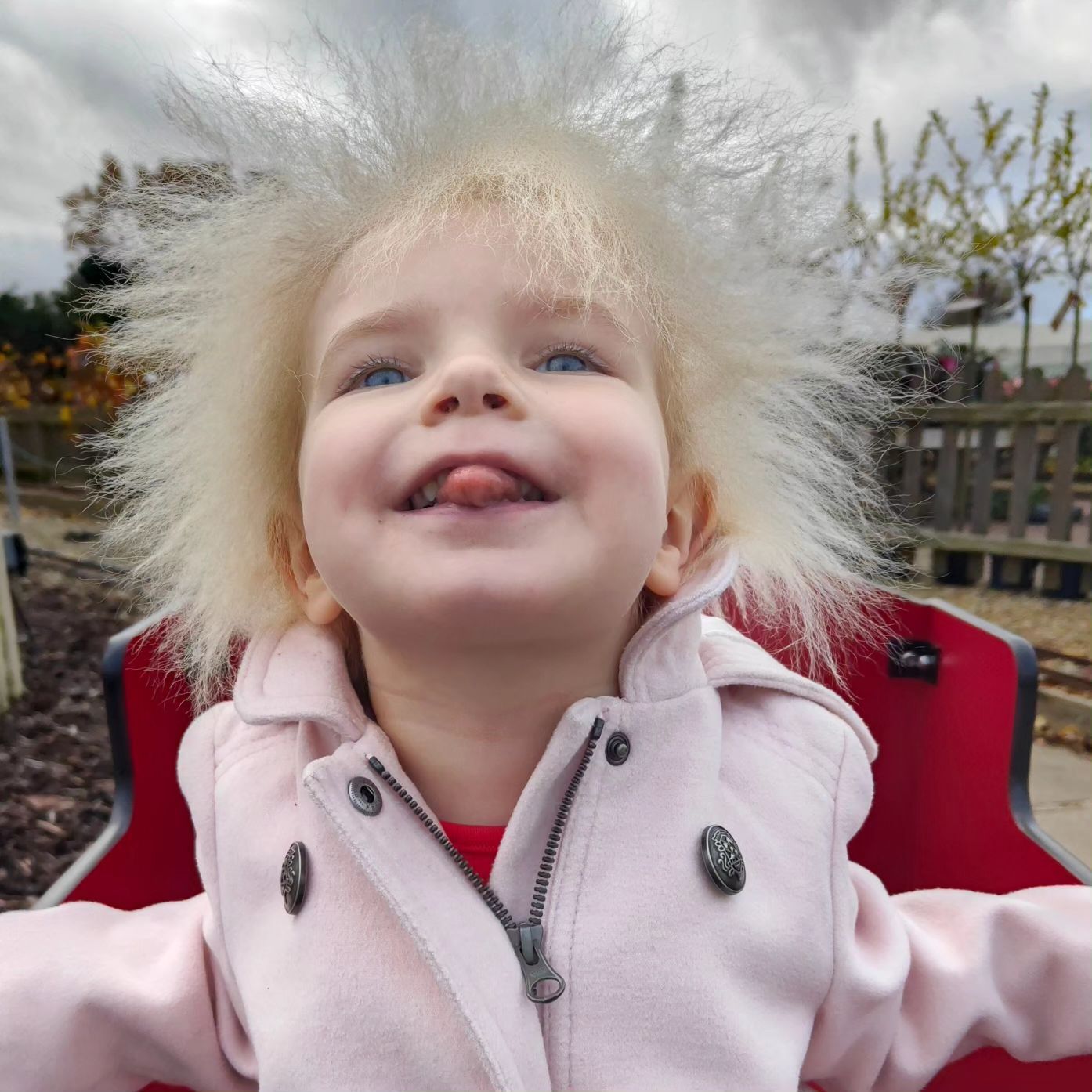 A three-year-old girl from Great Britain was diagnosed with uncombed hair syndrome: there are only 100 such people in the world. Photo.