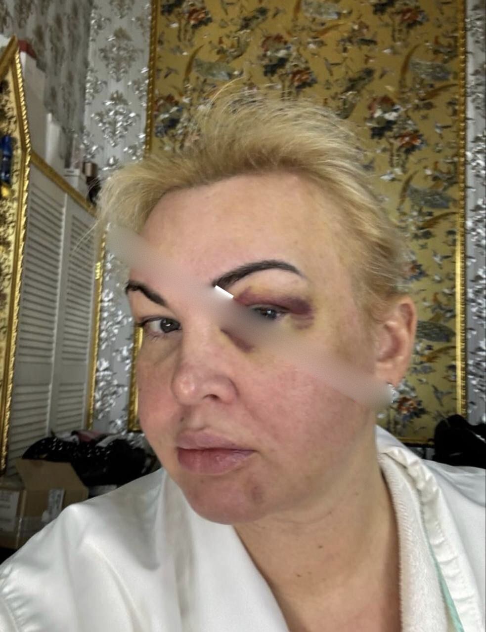 The network was shocked by photos of Kamalia in bruises and blood: the singer reacted