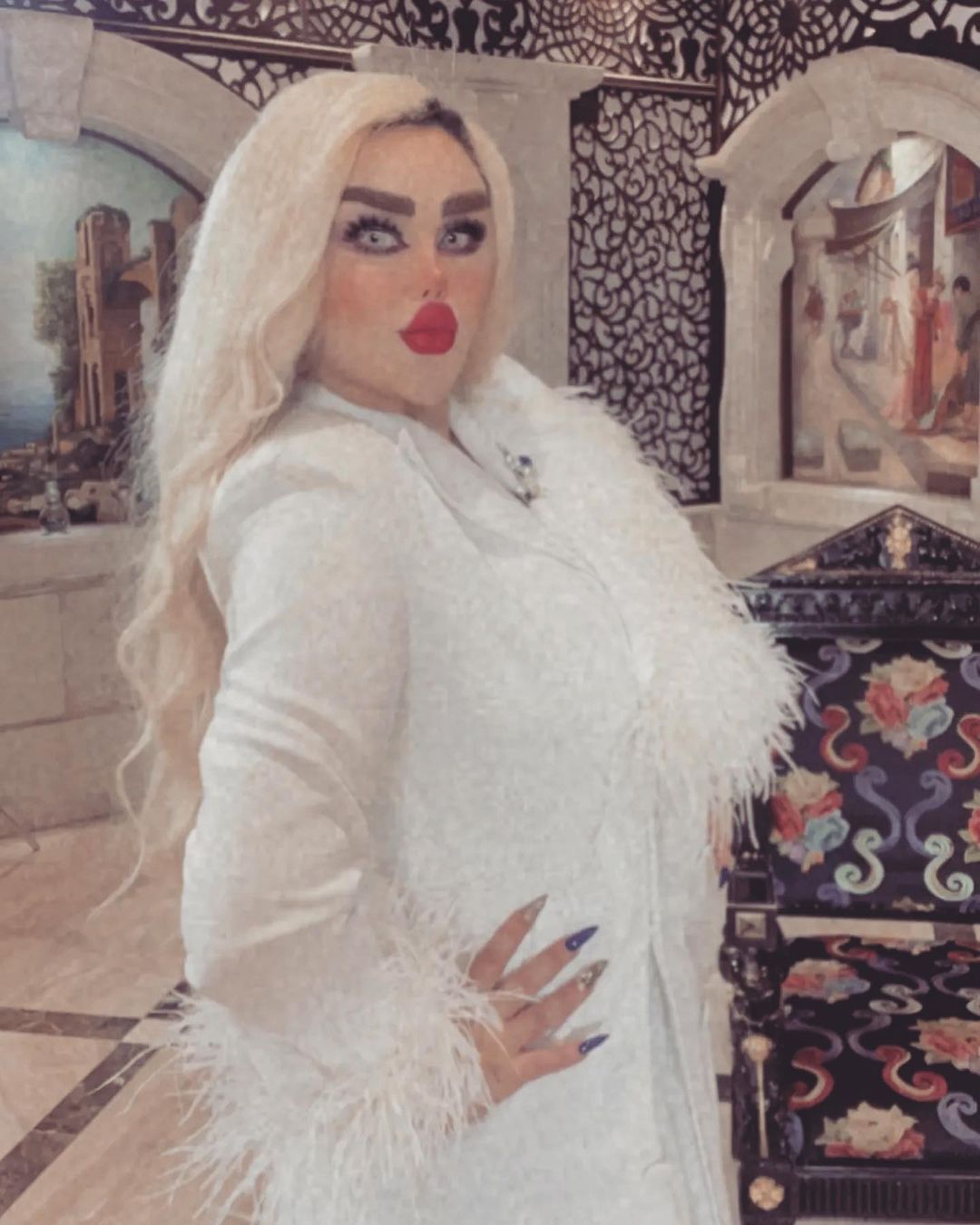 Iraqi woman underwent 43 surgeries to look like a Barbie doll: here's how it turned out