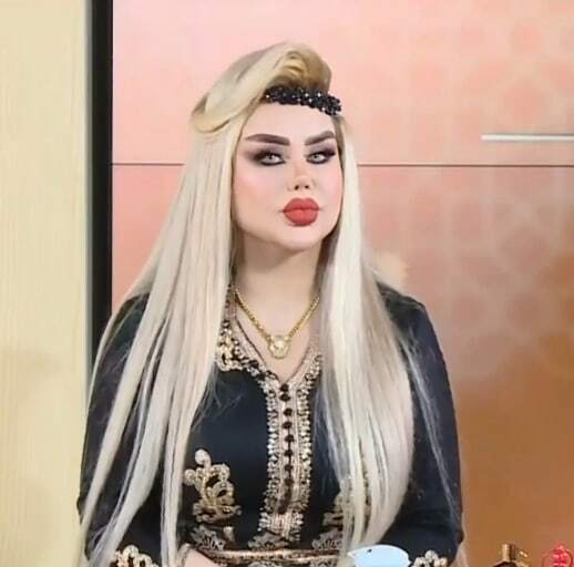 Iraqi woman underwent 43 surgeries to look like a Barbie doll: here's how it turned out