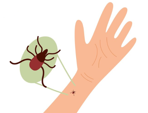 Never do this: what actions after a tick bite can add to the damage