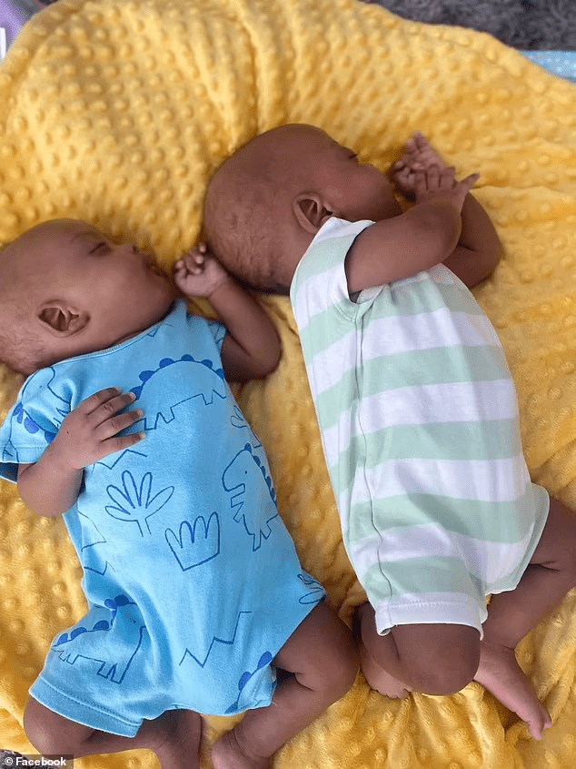 Siamese twins from London, who were separated at three months old, celebrated their first birthday. What Zayne and Zion look like now