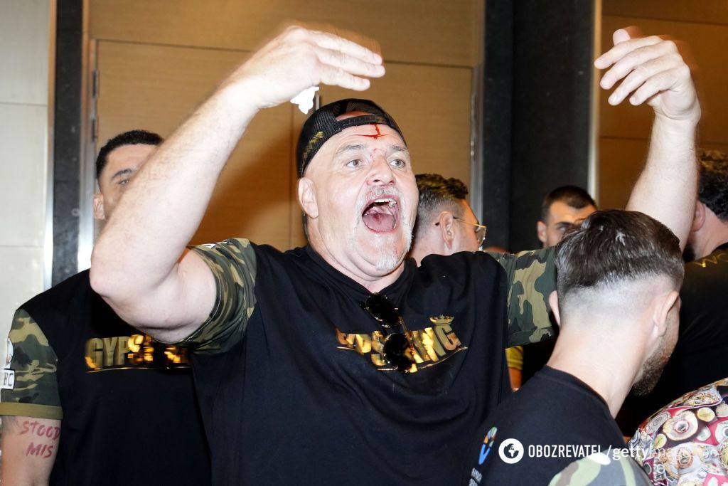 He threw himself at Ukrainians and broke his face: Fury's father had a fight with Usyk's team. Photos and videos