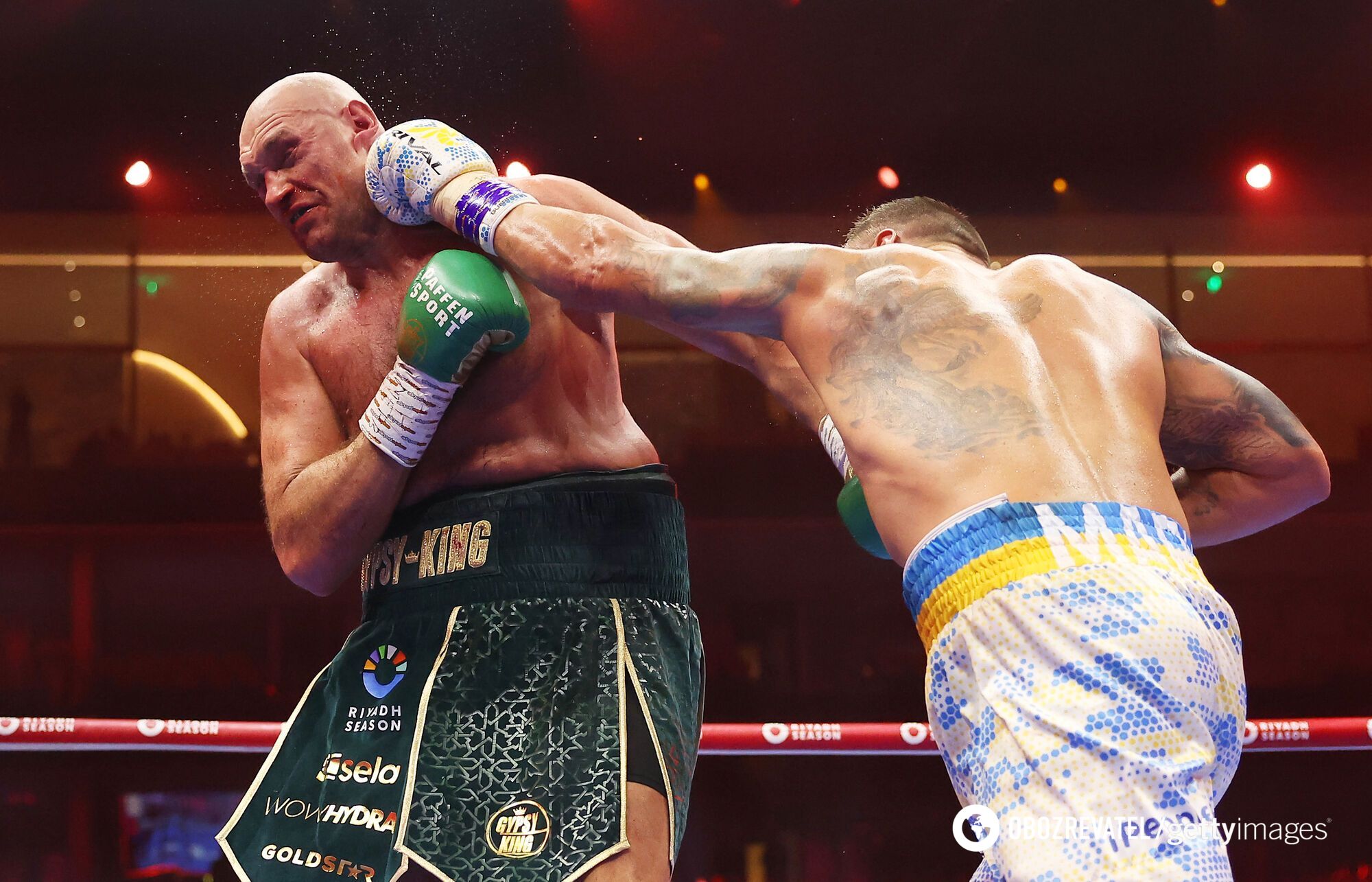 Had to go to a hospital: Usyk shows what his face looks like after 111 missed punches to the head from Fury. Photo