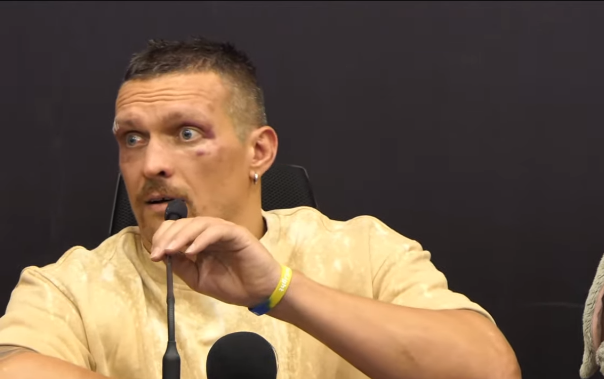 Had to go to a hospital: Usyk shows what his face looks like after 111 missed punches to the head from Fury. Photo