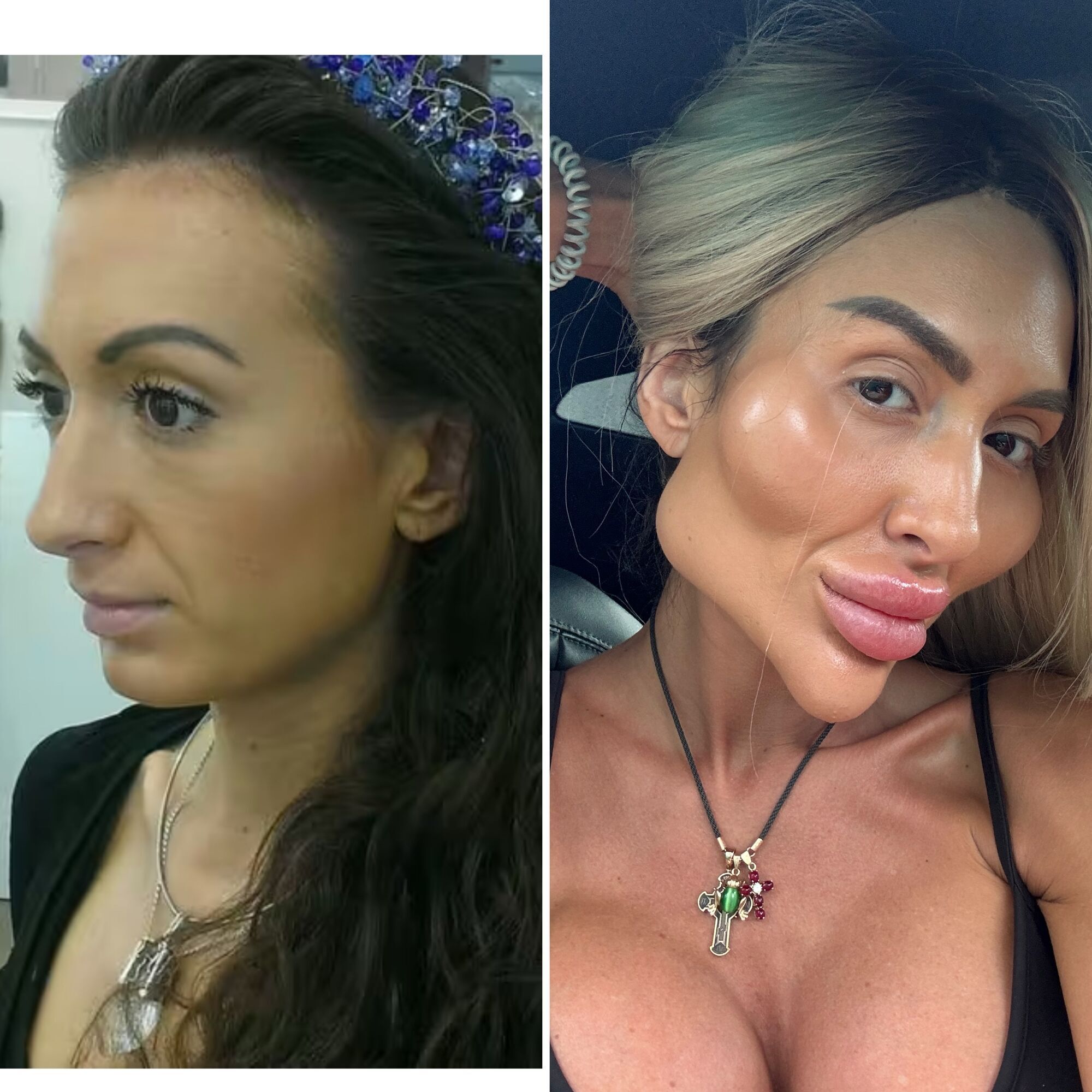 Curly hair, athletic figure: the Ukrainian with the largest cheekbones in the world showed what she looked like before her transformation. Fresh photos