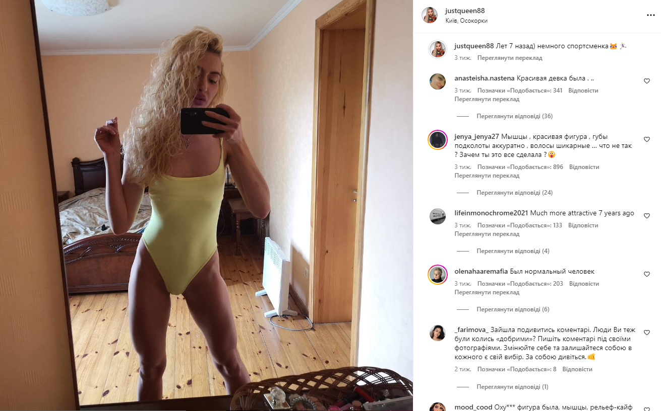 Curly hair, athletic figure: the Ukrainian with the largest cheekbones in the world showed what she looked like before her transformation. Fresh photos