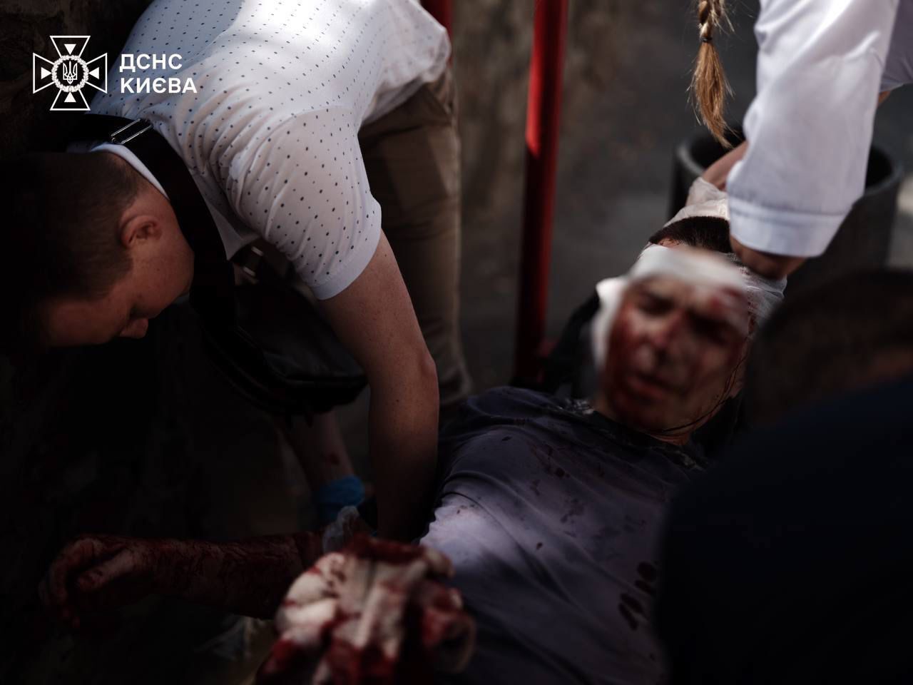 Explosions occurred in Kyiv and a children's medical institution was damaged: 10 people were killed and many injured as a result of the Russian attack. Photo