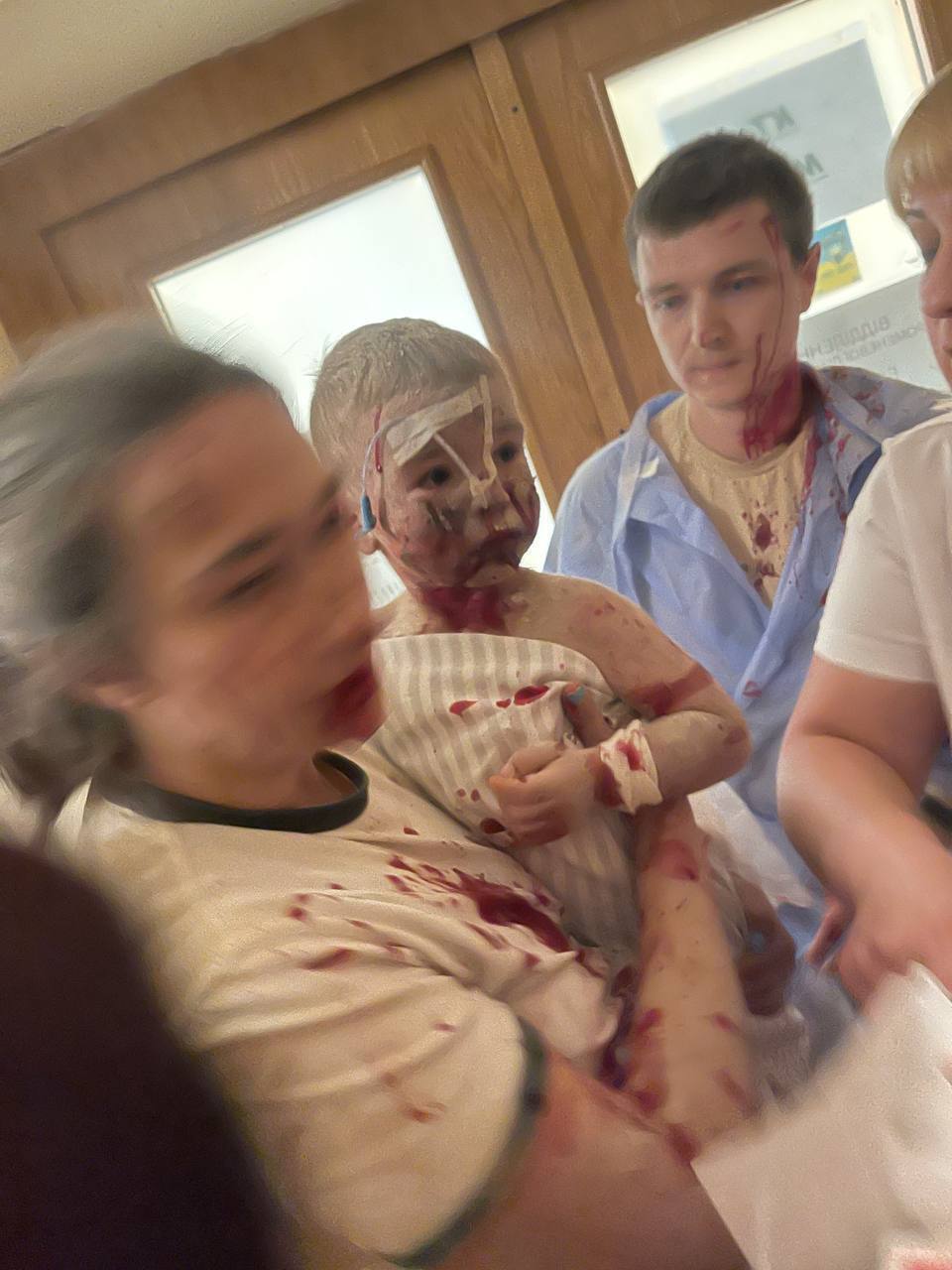 ''They targeted children on purpose'': Russia attacked the Okhmatdyt hospital in Kyiv, the rubble is being cleared. Photos and video